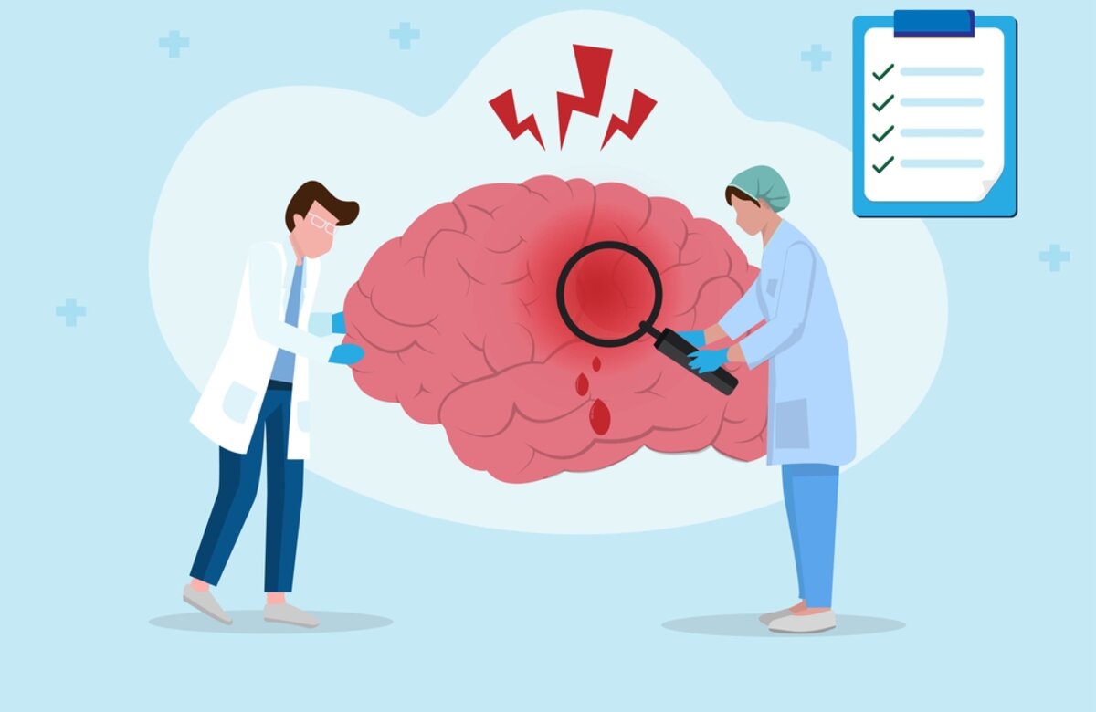 concept of brain disease and neurosurgery flat sty