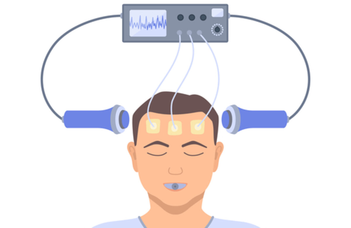 electroconvulsive therapy for severe depression an